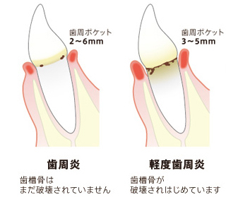 治療方法