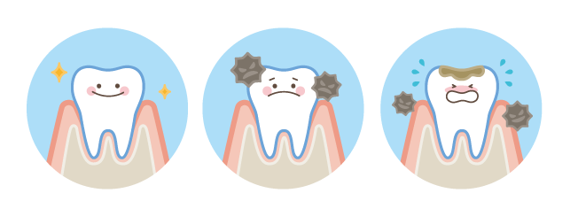 意外とわからない 歯周病と虫歯の違いとは 新板橋 板橋駅の歯医者 いしかわ歯科 平日夜9時まで